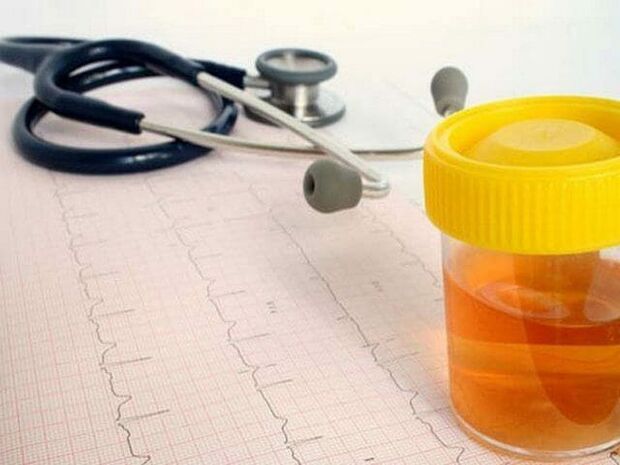 ανάλυση ούρων για τη διάγνωση της κυστίτιδας